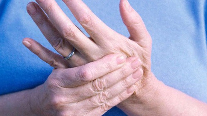 Thoái hóa đốt sống cổ gây tê tay do nguyên nhân nào?1