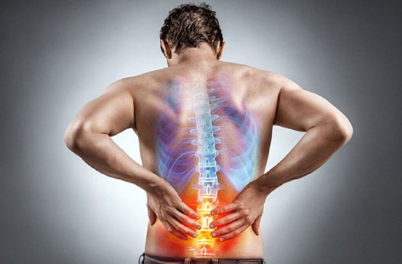 Thoát vị đĩa đệm nội xốp là bệnh gì? Cách phòng tránh và điều trị 2