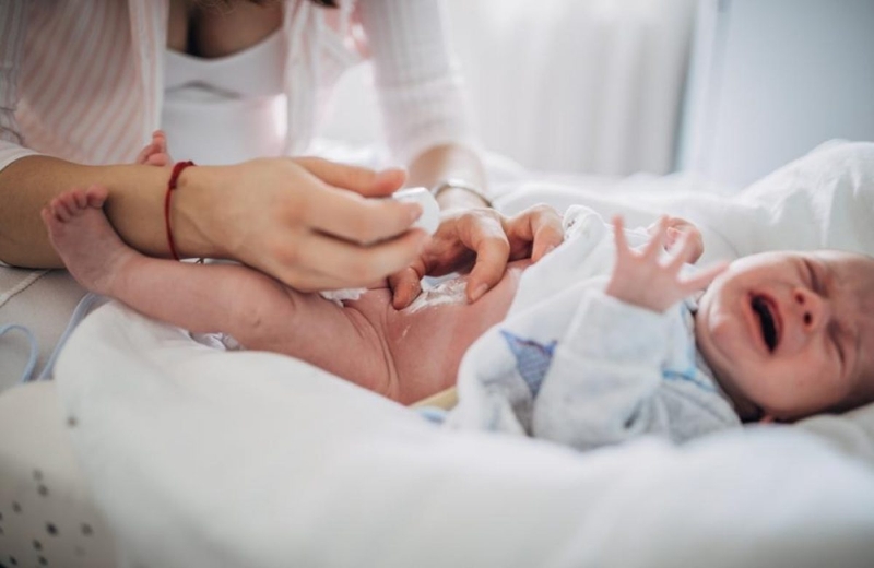 Cách điều trị thoát vị rốn ở trẻ sơ sinh
