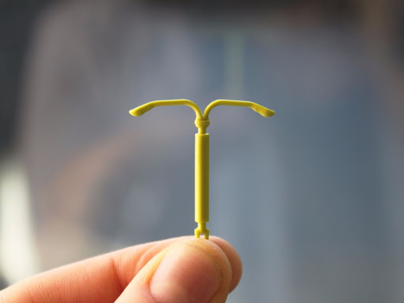 Thời điểm có thể đặt vòng tránh thai sau khi sinh con 1