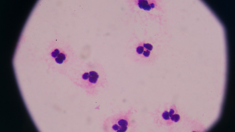 Thời điểm tiêm vắc xin phòng các bệnh do phế cầu khuẩn cho trẻ?1