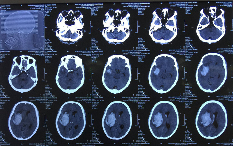 Thời gian chụp CT bao lâu? Khi nào nhận được kết quả? 1