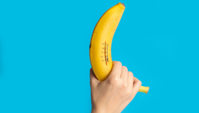 Thời gian thích hợp tháo ghim bao quy đầu​ và chăm sóc sau thủ thuật nam giới nên biết 1