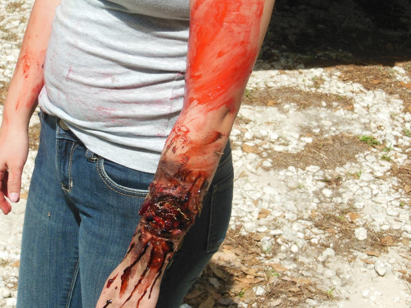 thời gian ủ bệnh dại ở người 2