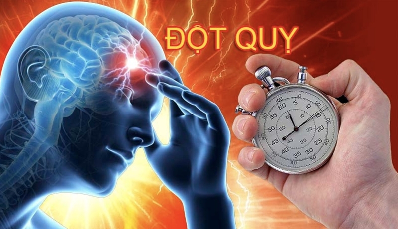Thời gian vàng sơ cứu đột quỵ hiệu quả nhất 1