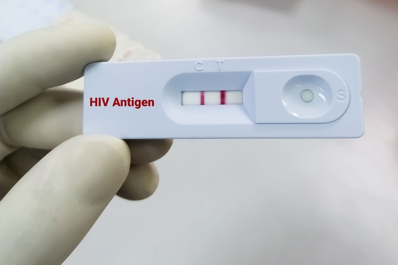 Thời gian xét nghiệm HIV cho kết quả chính xác nhất! 4