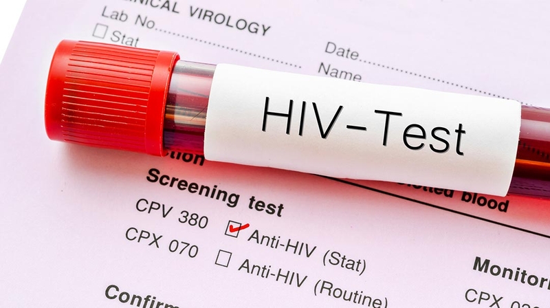 Thời gian xét nghiệm HIV cho kết quả chính xác nhất! 1