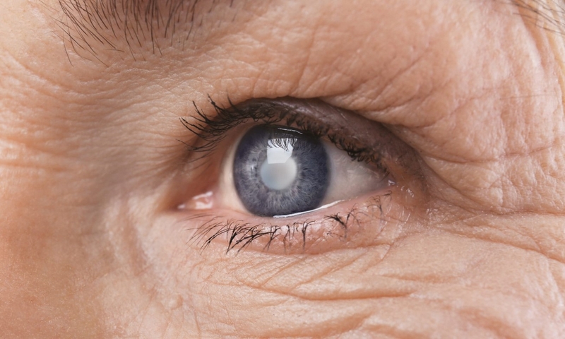 Thói quen dụi mắt có tốt không? Làm thế nào để hạn chế thói quen này 3