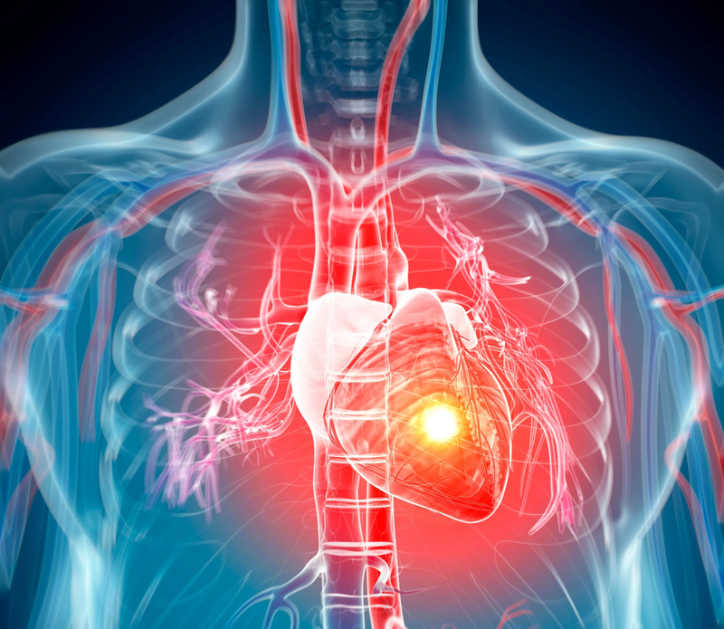 Thông liên nhĩ lỗ thứ phát có nguy hiểm không? 4