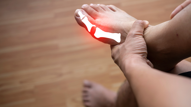 Thống phong là bệnh gì? Liệu bạn có đang mắc phải? 2