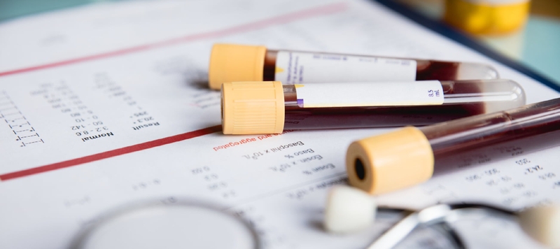 Những thông tin cần biết: Xét nghiệm máu tổng quát biết được những bệnh gì? 2