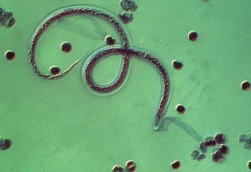 Thông tin sức khỏe: Loài giun nào gây ra bệnh chân voi ở người2