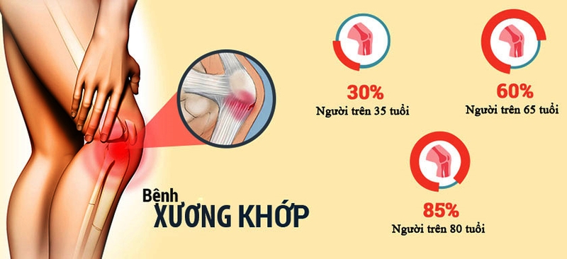 Thông tin viên uống bổ sung Canxi, giảm nguy cơ loãng xương Pharma Word Calci K-2 60V 2