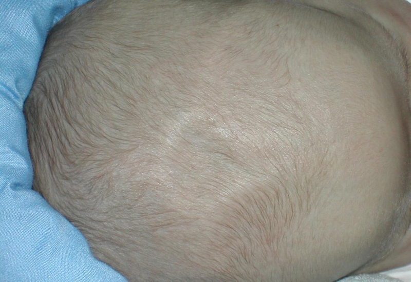 Thóp trẻ phập phồng - có phải dấu hiệu đáng lo? 2