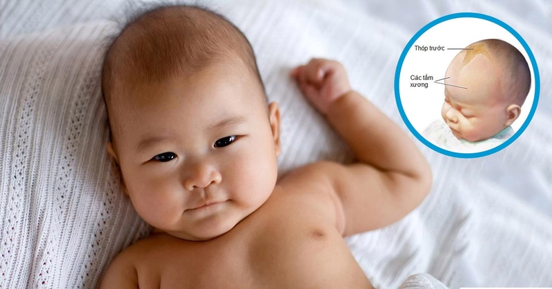 Thóp trẻ sơ sinh như thế nào là bình thường? 2