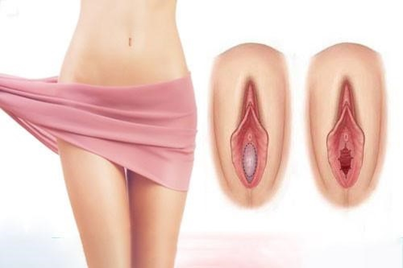 Thủ dâm có mất trinh không? Lưu ý khi thủ dâm 1