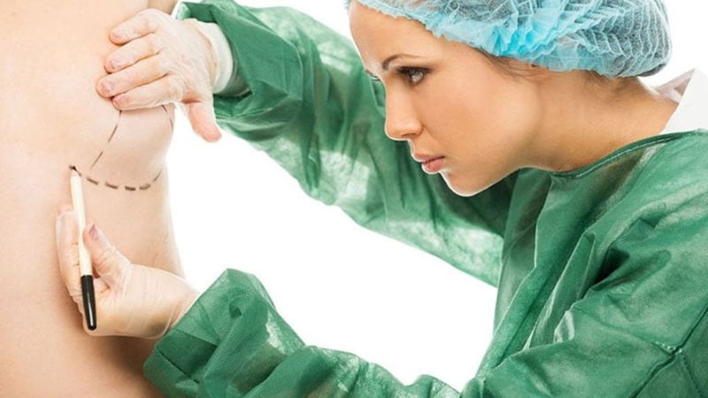 Thu gọn quầng vú: Thực hiện ra sao và chăm sóc thế nào? 2