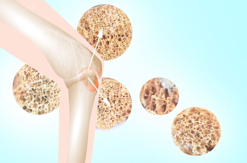 Thức ăn không tốt cho xương mà chúng ta cần tránh 1