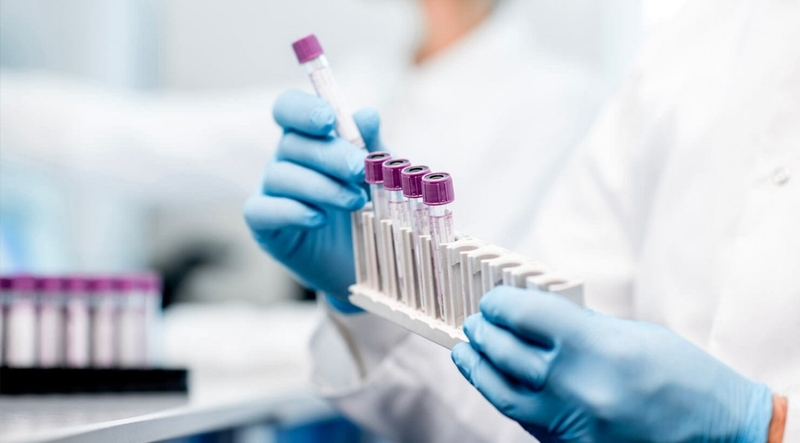 Thực hiện xét nghiệm nội tiết tố nữ bao nhiêu tiền? -1