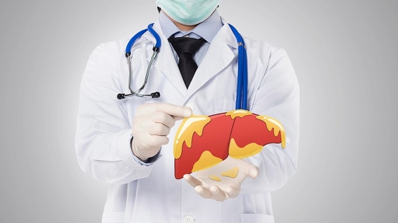 Thực hư việc uống trà và cà phê chống được gan nhiễm mỡ di truyền 3