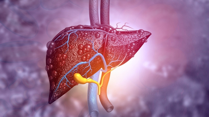 Thực hư việc uống trà và cà phê chống được gan nhiễm mỡ di truyền 2