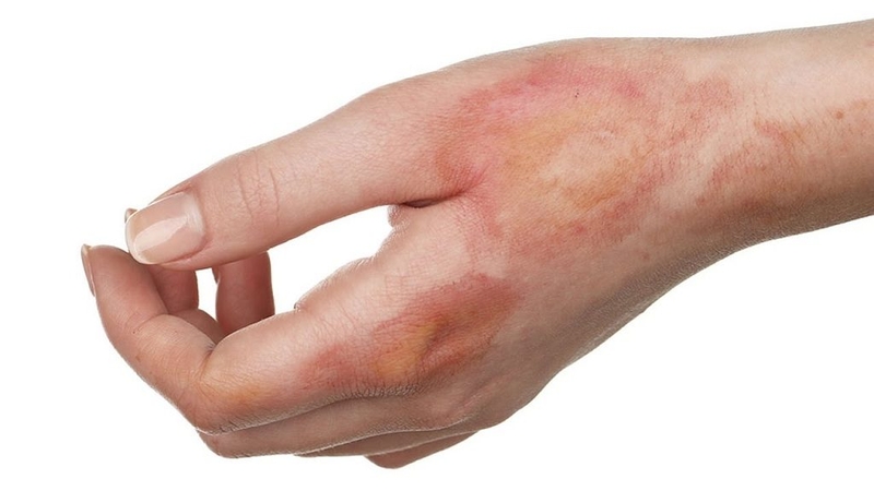 5 loại thực phẩm nhiều vitamin D không kém gì tắm nắng 1