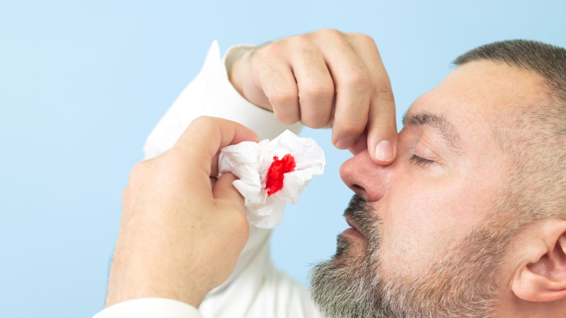 Thủng vách ngăn mũi: Nguyên Nhân, dấu hiệu và cách điều trị 3