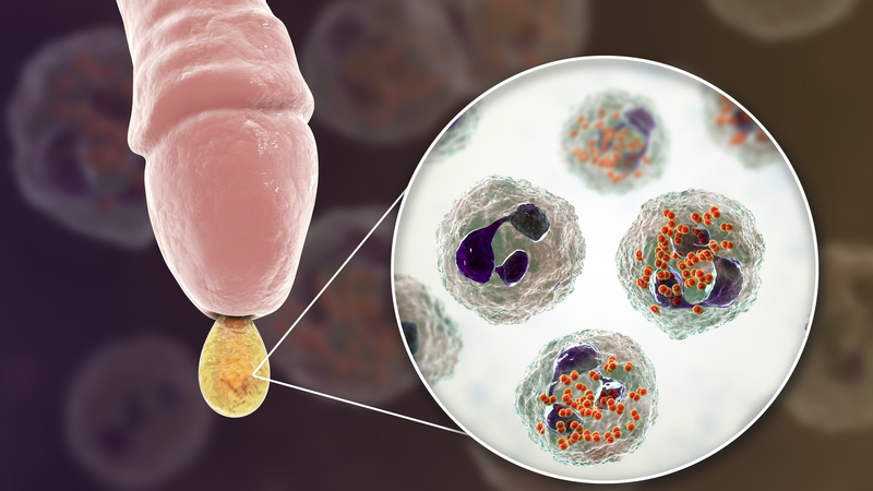 Thuốc bôi viêm bao quy đầu dùng như thế nào?