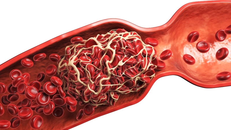 Thuốc chống đông máu đường uống dùng khi có nguy cơ hoặc đã xuất hiện huyết khối