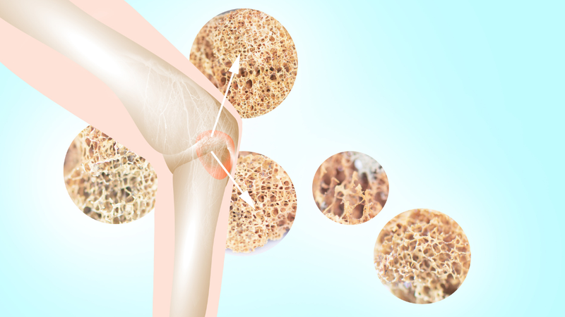 thuoc-chong-huy-xuong-la-gi-tim-hieu-ve-thuoc-chong-huy-xuong 1