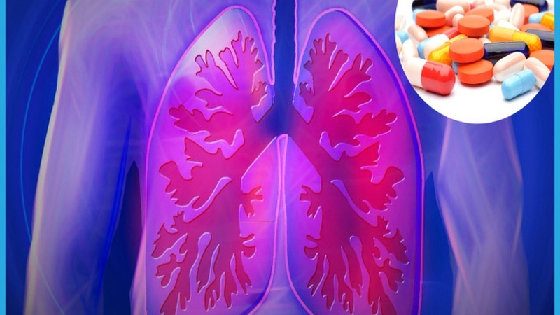 Thuốc chống xơ phổi: Hiểu rõ về lợi ích và tác dụng phụ của thuốc 2