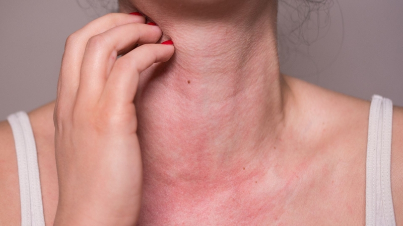 Nên đi khám nếu có dấu hiệu phản ứng dị ứng nghiêm trọng
