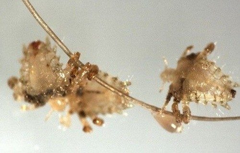 Thuốc dep trị rận mu có hiệu quả không 1