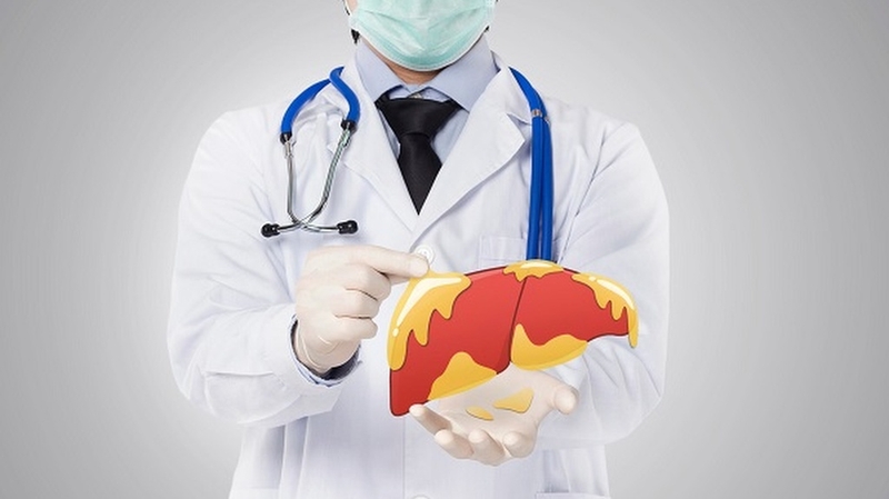 Thuốc điều trị gan nhiễm mỡ NASH đầu tiên được FDA Hoa Kỳ phê duyệt 2