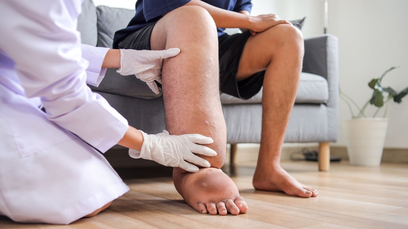 Thuốc điều trị giun chỉ bạch huyết: Thông tin cần biết để bảo vệ sức khỏe 1