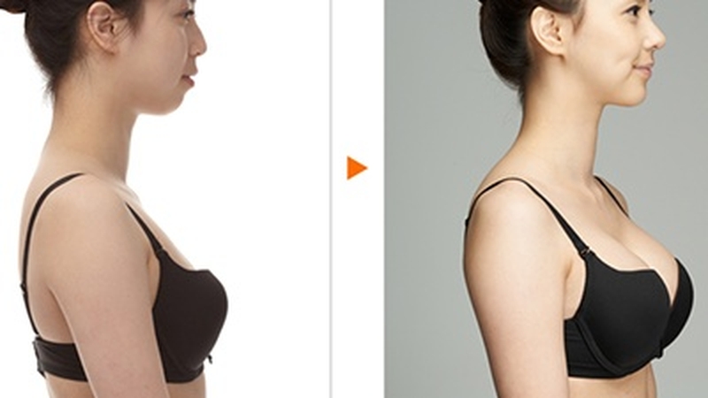 3 bài thuốc Đông y giúp tăng kích thước vòng 1 đầy đặn an toàn 1