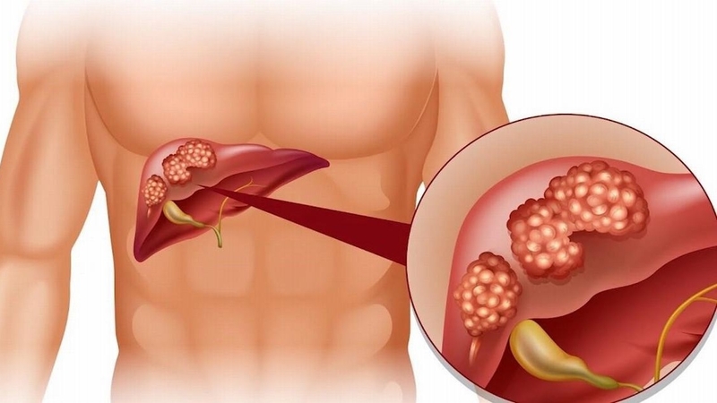 Thuốc Fahado là thuốc gì? Những điều cần biết khi sử dụng thuốc Fahado 3