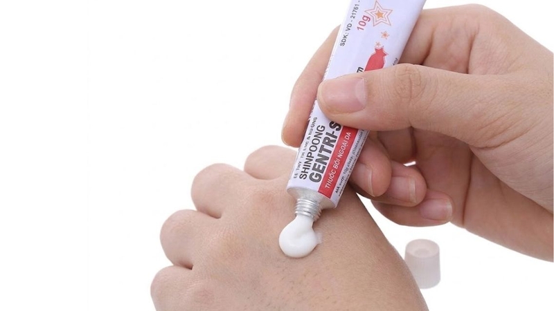 Gentrisone chỉ nên dùng ở vùng da ngoài cơ quan sinh dục theo chỉ định của bác sĩ