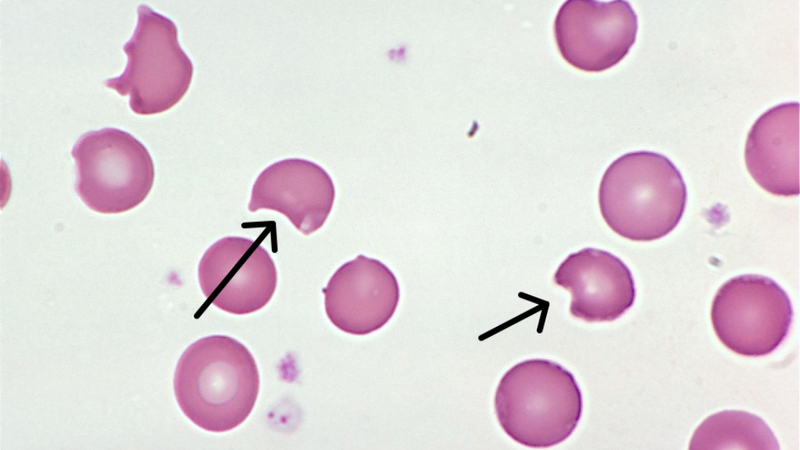 thuoc-ha-sot-cho-tre-thieu-g6-pd 1
