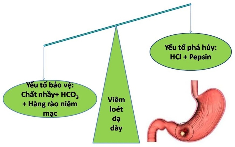Thuốc kháng acid uống tốt nhất vào lúc nào? 1