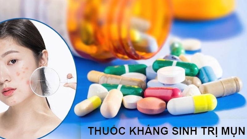 Thuốc kháng sinh trị mụn nhọt có những loại nào? Sử dụng khi nào? 3