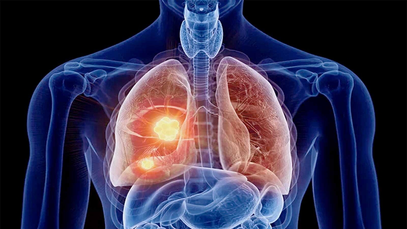 Thuốc lá và các bệnh do thuốc lá gây ra 2