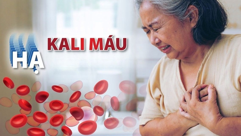 Thuốc lợi tiểu có thể làm tăng đào thải kali qua nước tiểu