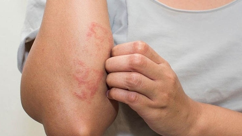 Thuốc Me2B có công dụng gì? Những điều cần biết khi sử dụng thuốc&nbsp;Me2B 2