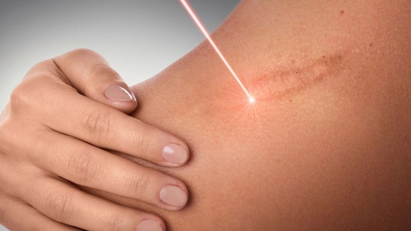 Thuốc mỡ kháng sinh bôi vết thương hở và những điều bạn cần biết 1