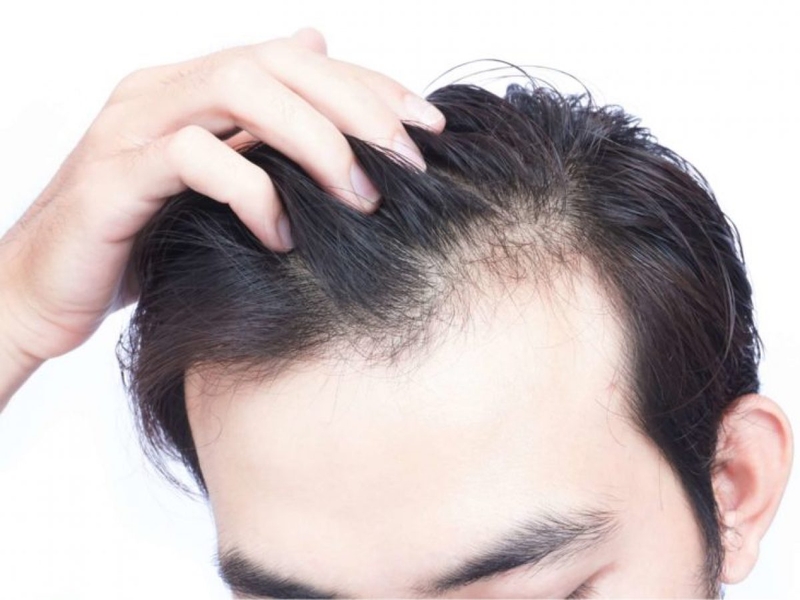 Thuốc mọc tóc Qik Hair có tốt không? 3