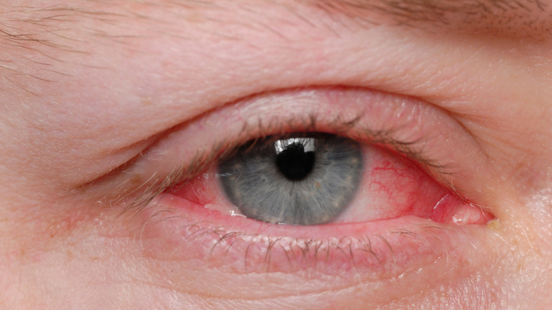 Thuốc nhỏ mắt Ofloxacin có nhỏ tai được không? Cách chọn thuốc nhỏ tai phù hợp1