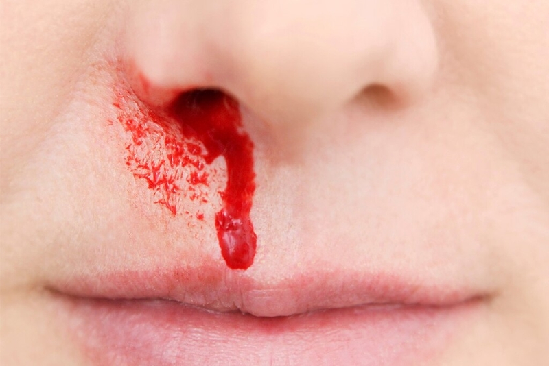 Thuốc Ridlor 75mg có tác dụng gì? Một số lưu ý khi sử dụng Ridlor 75mg 2