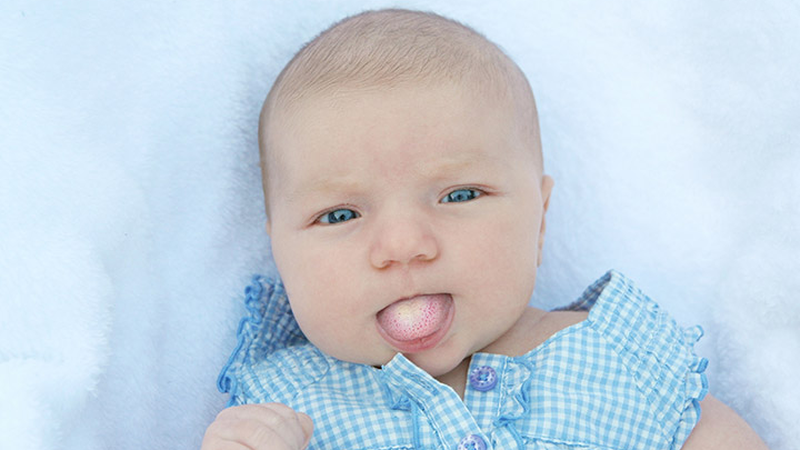 Thuốc rơ lưỡi cho trẻ sơ sinh Nyst có trị được tưa lưỡi? 1