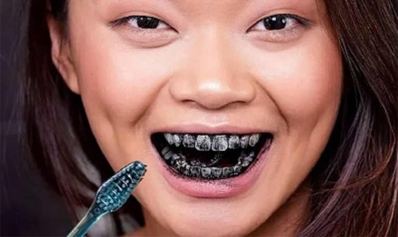 Thuốc tẩy trắng răng có tốt không? Nên dùng tại nhà như thế nào? 2